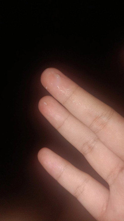 มูกก่อนคลอด