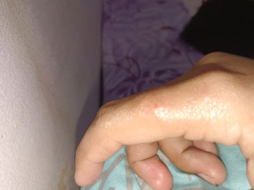 kutu kucing