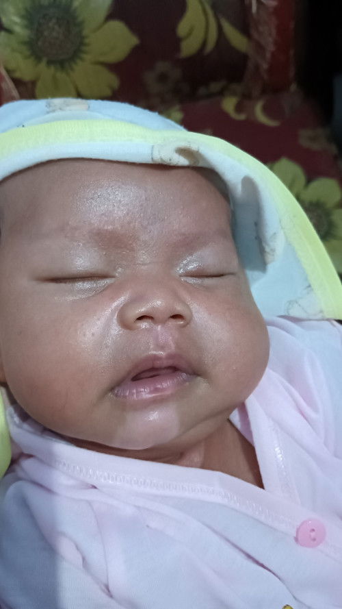 Dagu ada bercak putih
