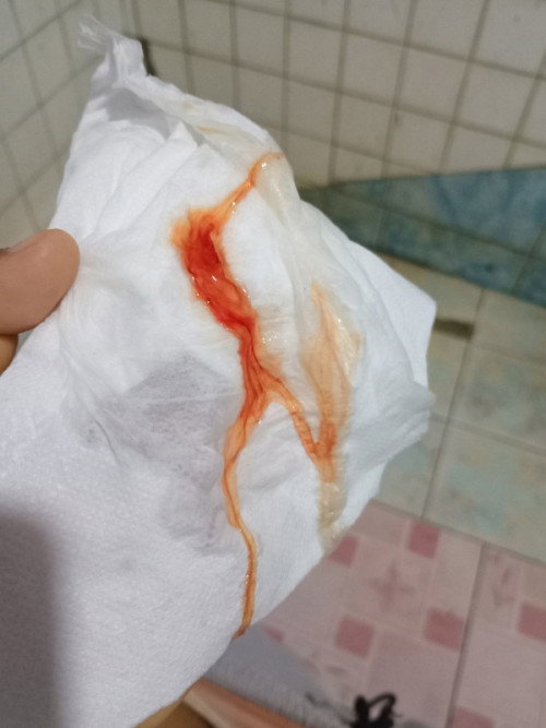 แบบนี้ต้องไปหาหมอเลยมั้ยคะ