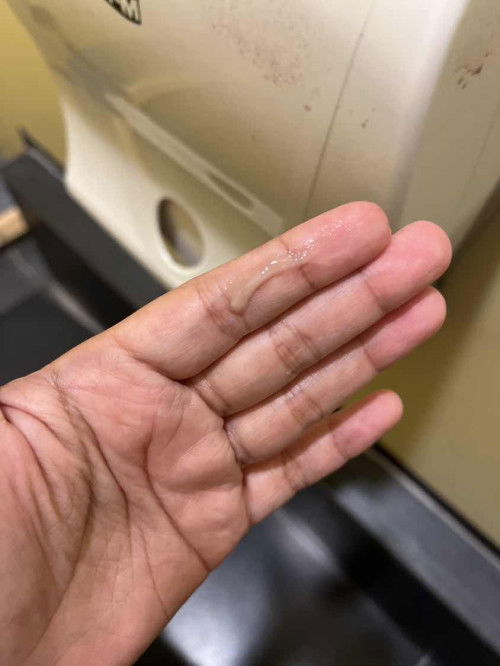 Adakah nie tanda spotting ?