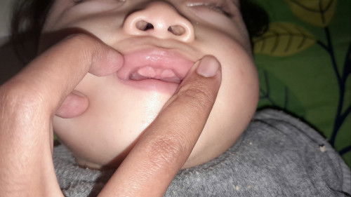 Tumbuh gigi pertamakali