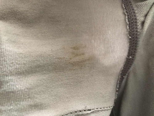 Maaf, kalau keluar coklat macam ni? Patut gi klinik ke? Sekali ni je keluar. Takde bau, tak gatal.