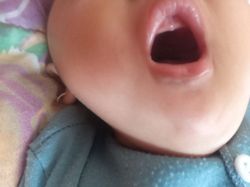 Gusi bayi