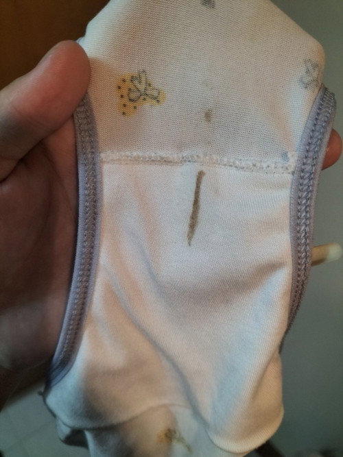 แบบนี้ต้องไปหาหมอมั๊ย