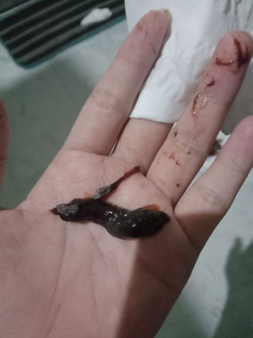Hpl 19mei 38 minggu