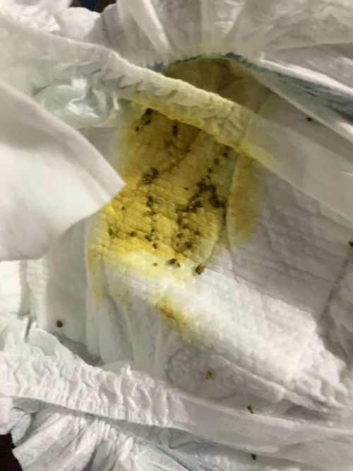 อึเป็นเม็ดแข็ง