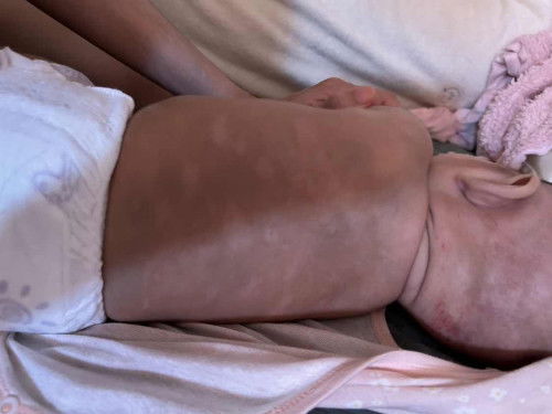 Sabun baby kulit kering