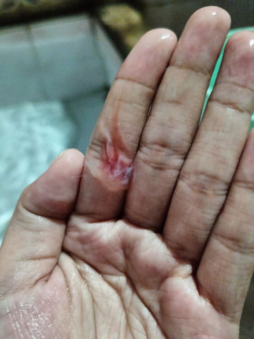 lendir campur darah