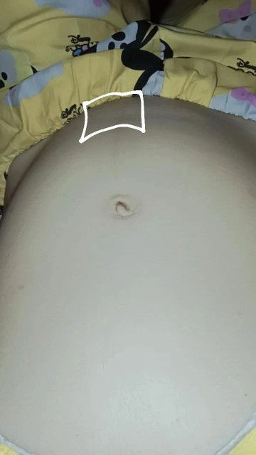 Letak janin 16 weeks