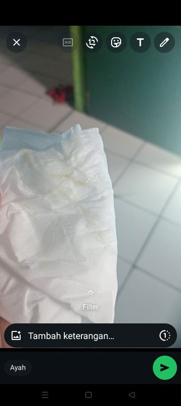 Bun apa ini tanda mau lahiran soalnya hpl besok