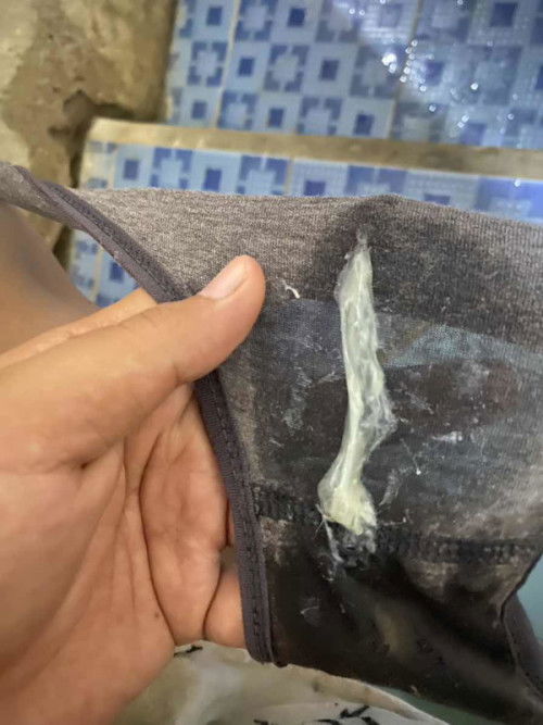 Lendir keputihan atau tanda lendir mau melahirkan?