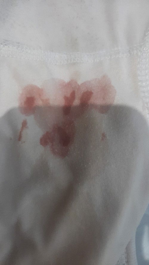 8 minggu keluar darah