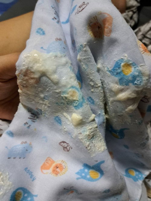 ลูกชอบอวกนมมื้อเย็น