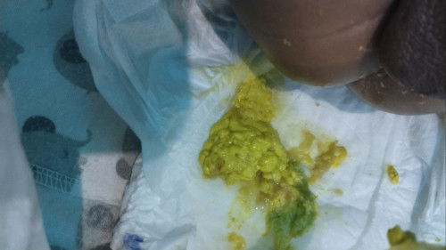 Pup bayi umur 1,5 bulan
Apakah normal pup berlendir dan berbiji kadang bisa 5x lebih sehari