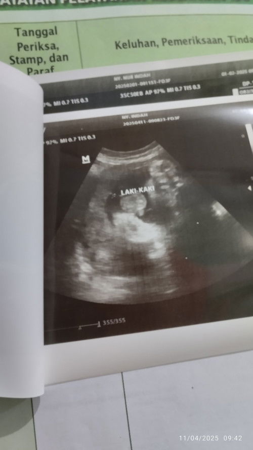 Bener2 sdh valid baby boy, atau masih bisa berubah ya?