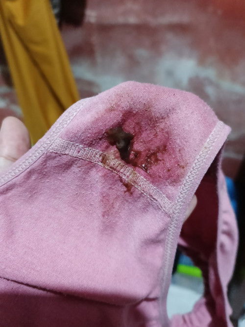 bingung tanda lahiran atau bukan