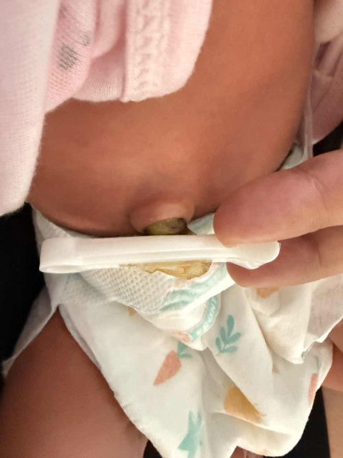Pusod (newborn)