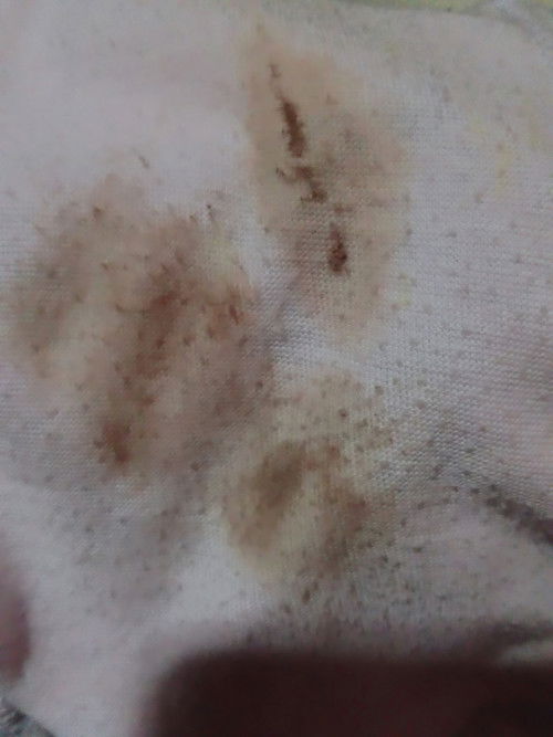 Bun maaf mau tanya usia kehamilan ku sudah 10minggu tadi ngeflek kayak gitu saya takut soalnya.