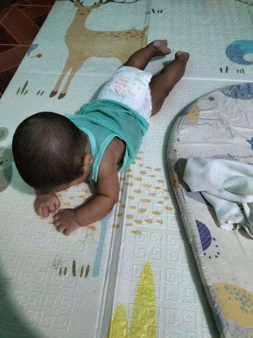ขอถามแม่ๆ น้องชอบเกร็งขา
