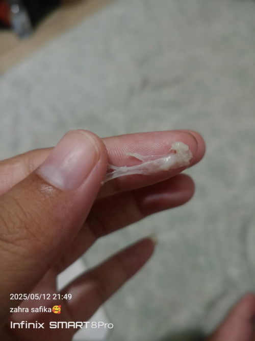 Keputihan seperti lendir