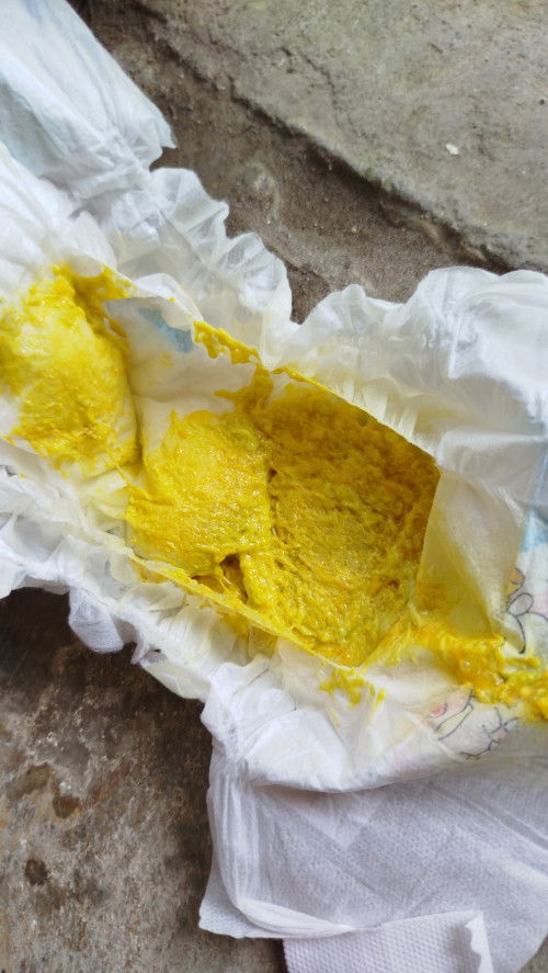 Pup bayi kuning pucat