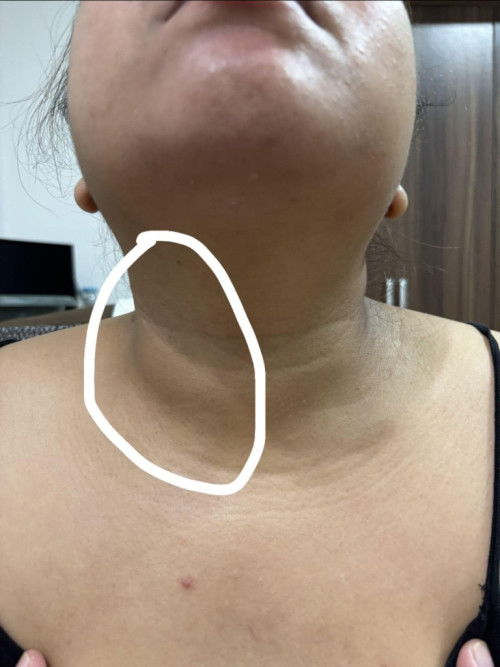 Bigger Ride Side of the Neck with No Pain