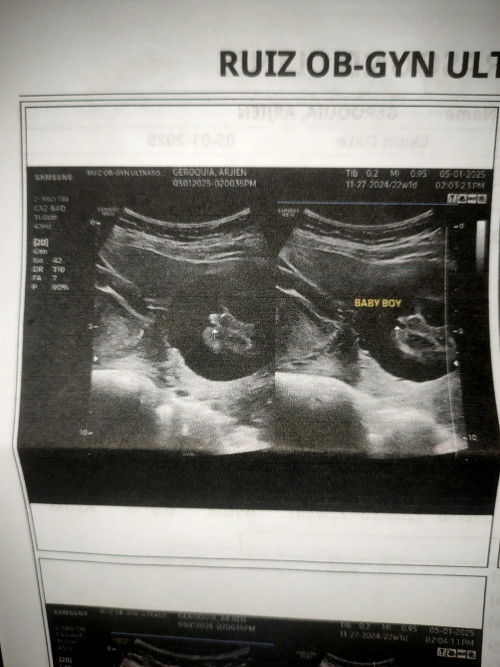 Baby's Gender