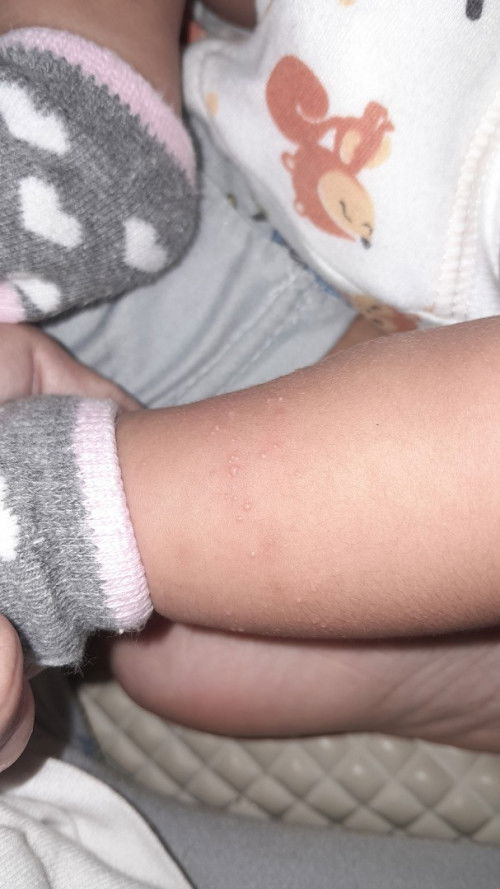 bentol2 isi air di kaki