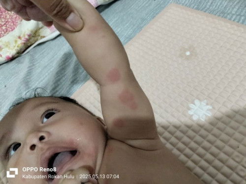 Ibu ada tidak anak nya seperti ini