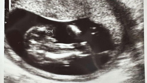 baby boy ke?