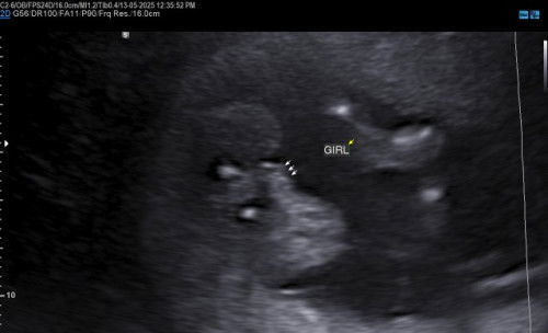 Scan Gender