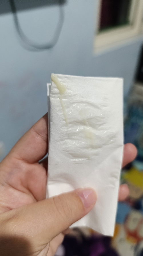 Mucus plug atau keputihan?