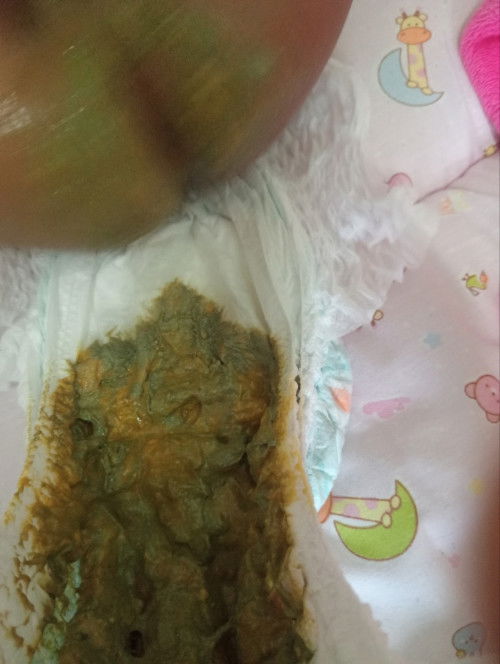อึของลูกน้อย