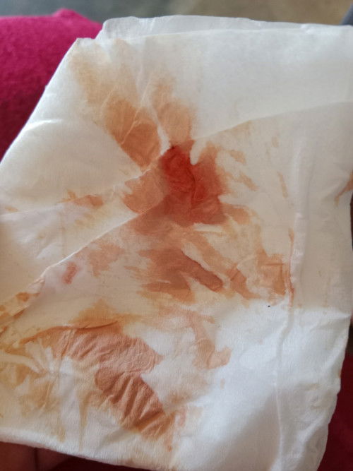 Usia kandungan 36w , perut kencang bagian bwah tapi kdg krasa kdg gk, kluar flek warna pink