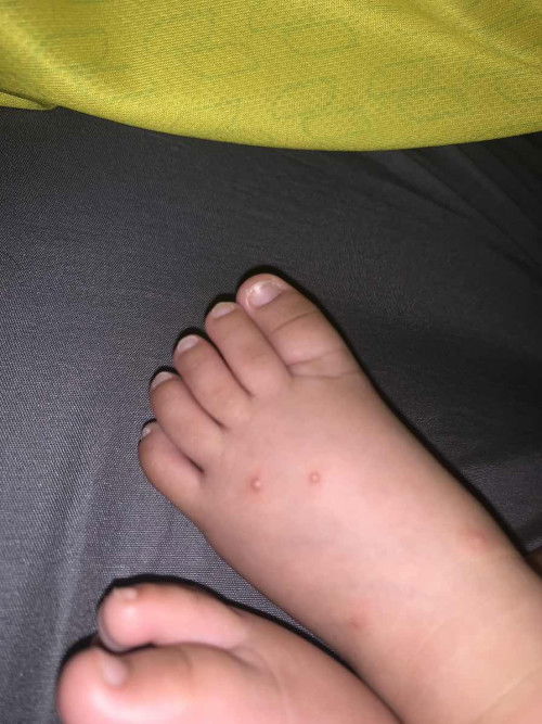 Hfmd ke ni?