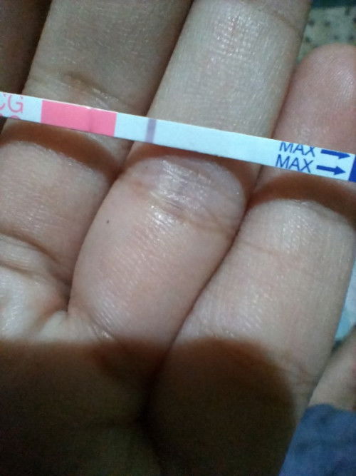 Bund apakah terlihat ada garis lagi.??
