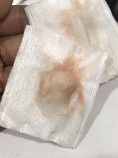 Period  atau sportting