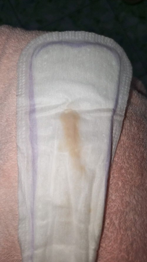 Keputihan atau spotting