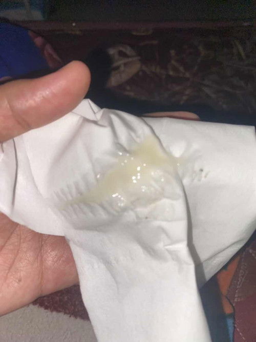 Apakah tanda” mau melahirkan