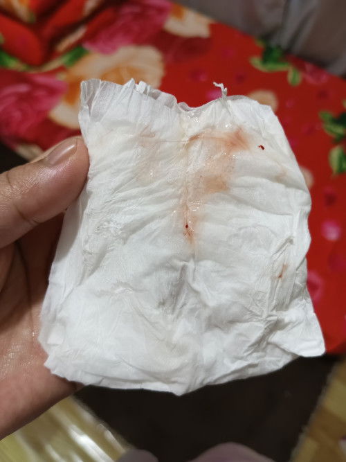 Flek apakah tanda melahirkan