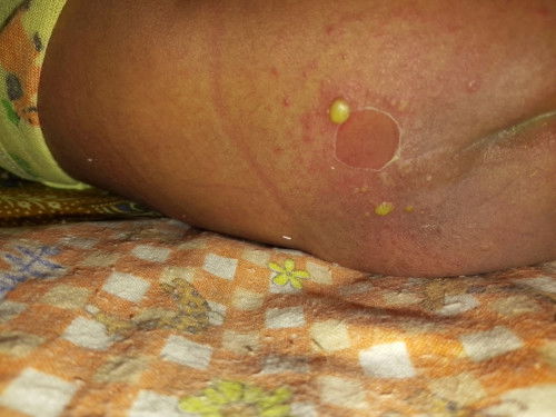Saran obat/salep
