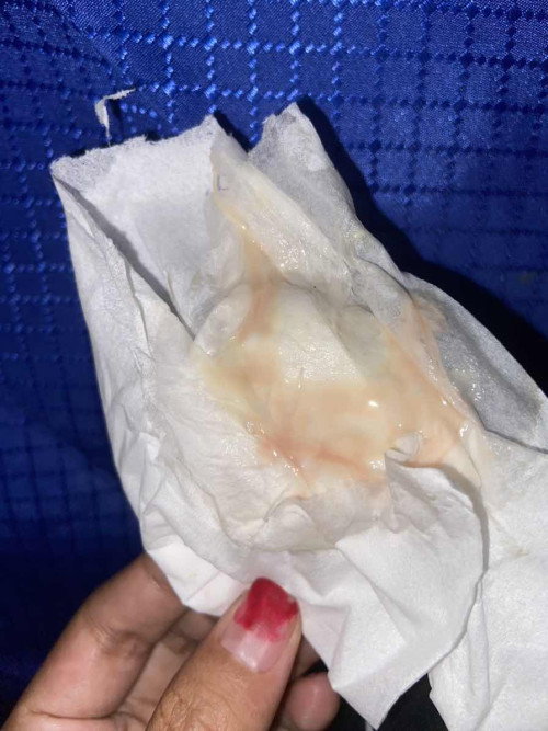 Bun ini normal ngga ya keputihan kayak gini,sering keluar soalnya.baru 32 week juga