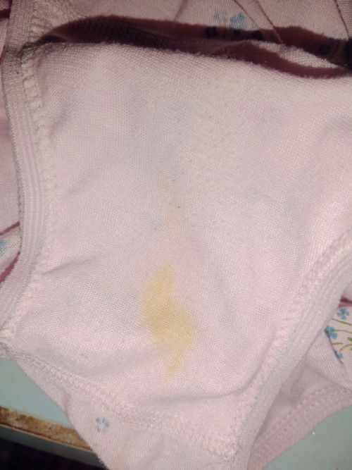 hamil 5week perut kenceng, keputihan warna kuning