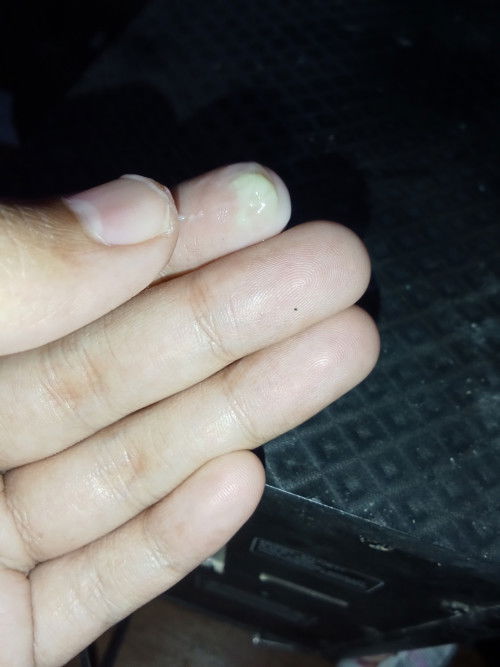Bun ini keputihan atw lendir yaa