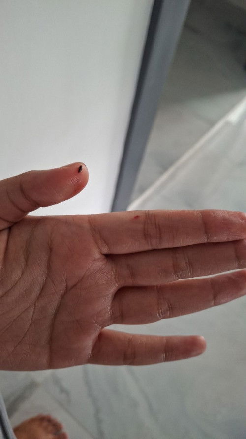 Flek gumpalan setetes