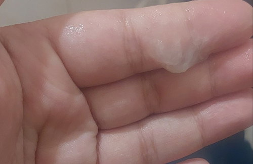 ตั้งครรภ์38w1d