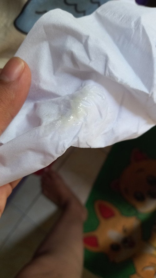 Keputihan setelah nifas
