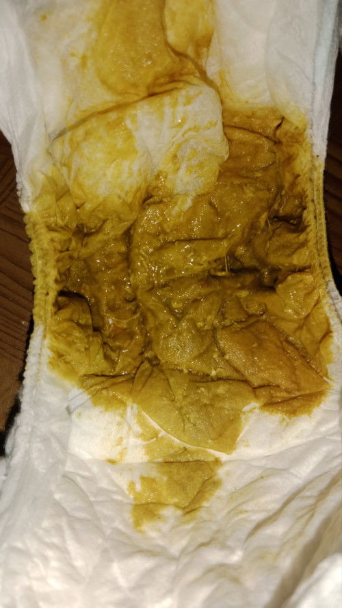 Bund mau tanya soal feses bayi