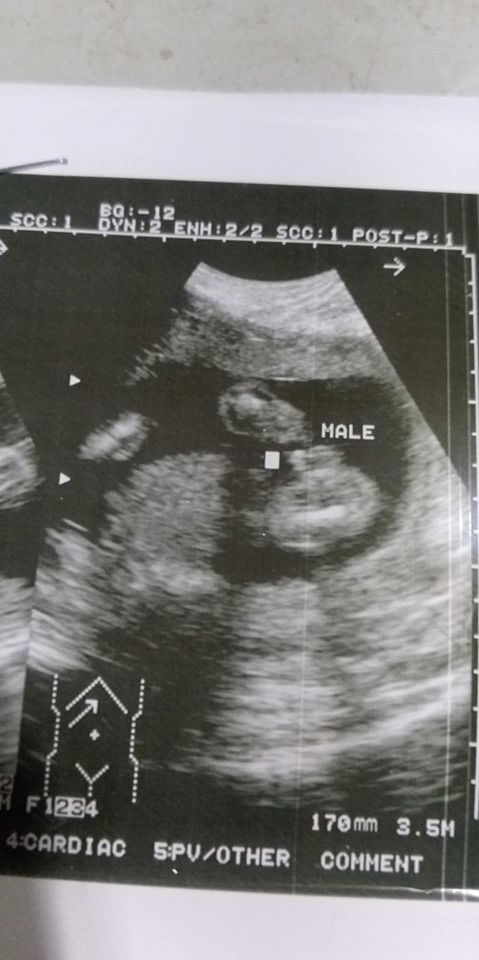 Baby boy na kaya?